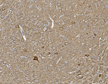 Kv1.1 potassium channel/KCNA1 Rabbit Polyclonal Antibody