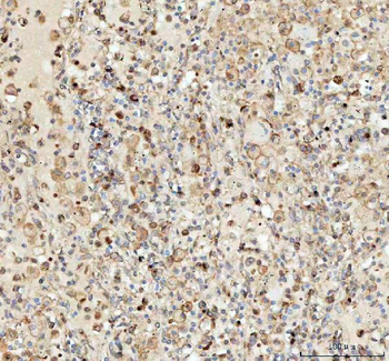 LMAN1 Rabbit Polyclonal Antibody