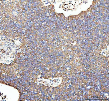 LMAN1 Rabbit Polyclonal Antibody