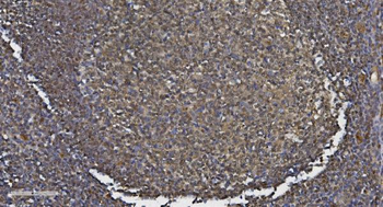 MEF2C Rabbit Polyclonal Antibody