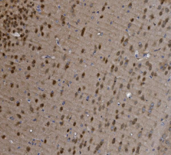 MEF2C Rabbit Polyclonal Antibody