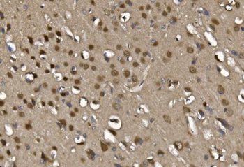 MEF2C Rabbit Polyclonal Antibody