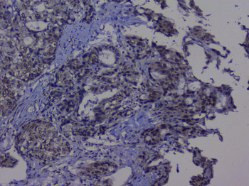 NRF1 Antibody