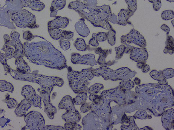 NRF1 Antibody