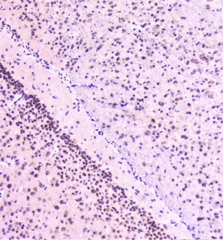 Rad51 Rabbit Polyclonal Antibody