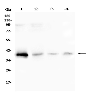 RP2 Rabbit Polyclonal Antibody