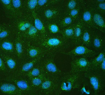 RP2 Rabbit Polyclonal Antibody