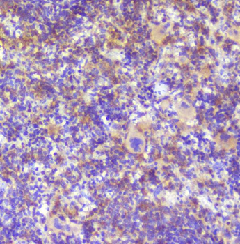 RP2 Rabbit Polyclonal Antibody
