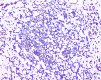 RPS3 Rabbit Polyclonal Antibody