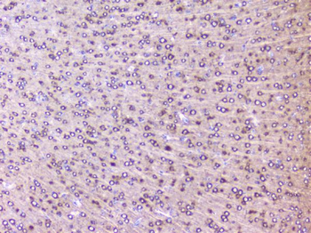 RPS3 Rabbit Polyclonal Antibody