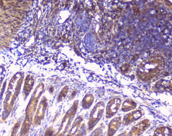 RPS3 Rabbit Polyclonal Antibody