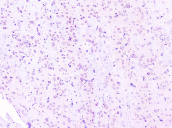 RPS3 Rabbit Polyclonal Antibody