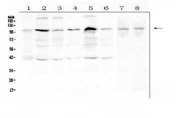 RSK3/RPS6KA2 Rabbit Polyclonal Antibody