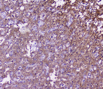 SNAP25 Rabbit Polyclonal Antibody