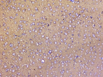 SNAP25 Rabbit Polyclonal Antibody