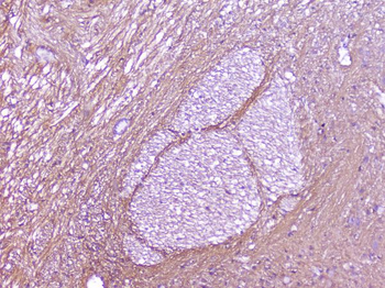 SNAP25 Rabbit Polyclonal Antibody