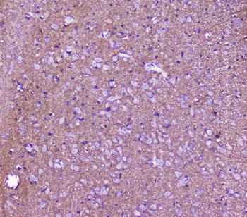 SNAP25 Rabbit Polyclonal Antibody