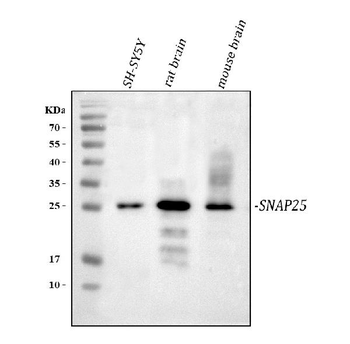 SNAP25 Rabbit Polyclonal Antibody