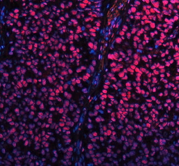 SP1 Rabbit Polyclonal Antibody