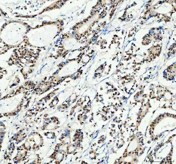 SP1 Rabbit Polyclonal Antibody