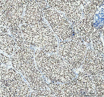 SP1 Rabbit Polyclonal Antibody