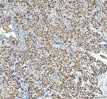 SP1 Rabbit Polyclonal Antibody