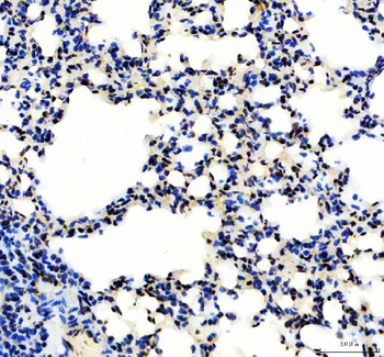 SP1 Rabbit Polyclonal Antibody