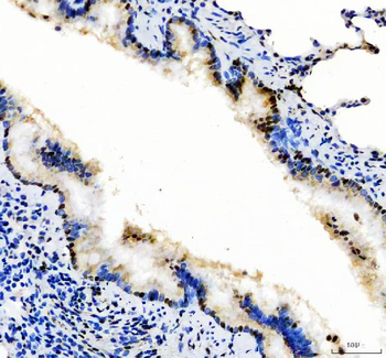 SP1 Rabbit Polyclonal Antibody