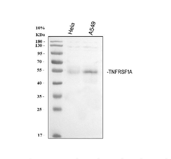 TNF Receptor I/TNFRSF1A Rabbit Polyclonal Antibody