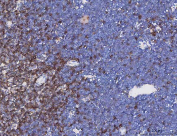 TCR alpha/TRAC Rabbit Polyclonal Antibody