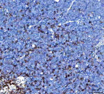 TCR alpha/TRAC Rabbit Polyclonal Antibody