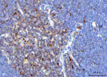 TCR alpha/TRAC Rabbit Polyclonal Antibody