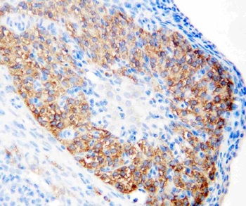hCG receptor/LHCGR Rabbit Polyclonal Antibody