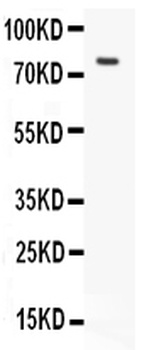 hCG receptor/LHCGR Rabbit Polyclonal Antibody