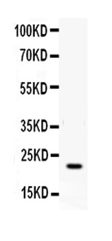 IFN gamma Rabbit Polyclonal Antibody