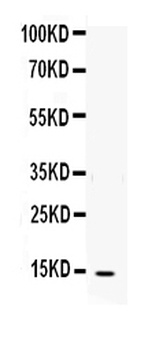 Interleukin-4 IL4 Rabbit Polyclonal Antibody