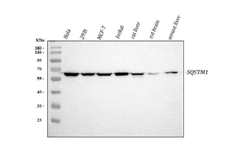 SQSTM1/p62 Antibody