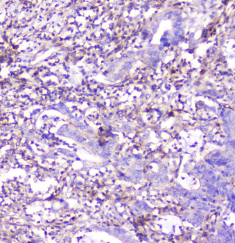 ADA Mouse Monoclonal Antibody