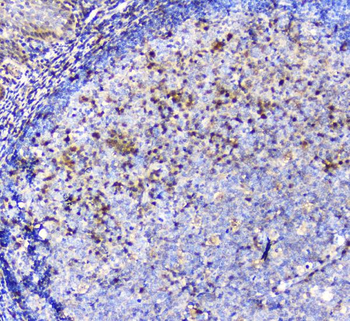 ADA Mouse Monoclonal Antibody