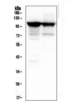ACTN3 Mouse Monoclonal Antibody