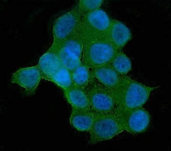 AKT2 Mouse Monoclonal Antibody