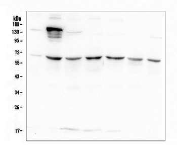 AKT2 Mouse Monoclonal Antibody