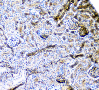 CD2AP Antibody (monoclonal, 5F8)
