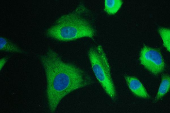 Calpain 2 CAPN2 Mouse Monoclonal Antibody