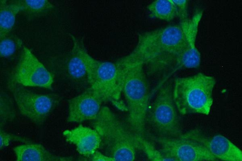 Calpain 2 CAPN2 Mouse Monoclonal Antibody