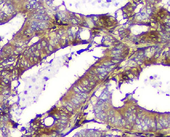 Calpain 2 CAPN2 Mouse Monoclonal Antibody