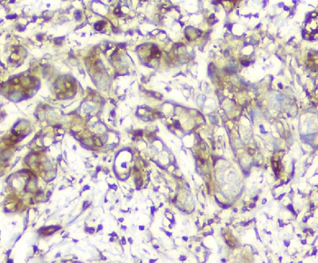 Calpain 2 CAPN2 Mouse Monoclonal Antibody