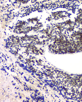 RPA70 RPA1 Mouse Monoclonal Antibody