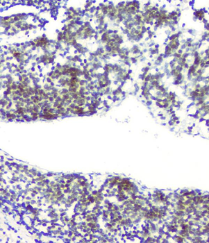 RPA70 RPA1 Mouse Monoclonal Antibody