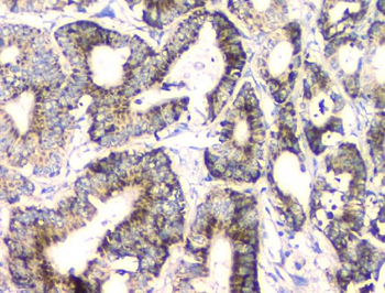 FH Mouse Monoclonal Antibody